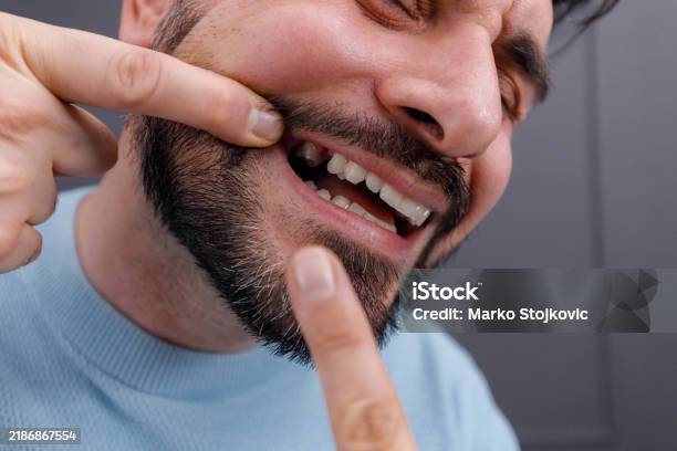 missing tooth